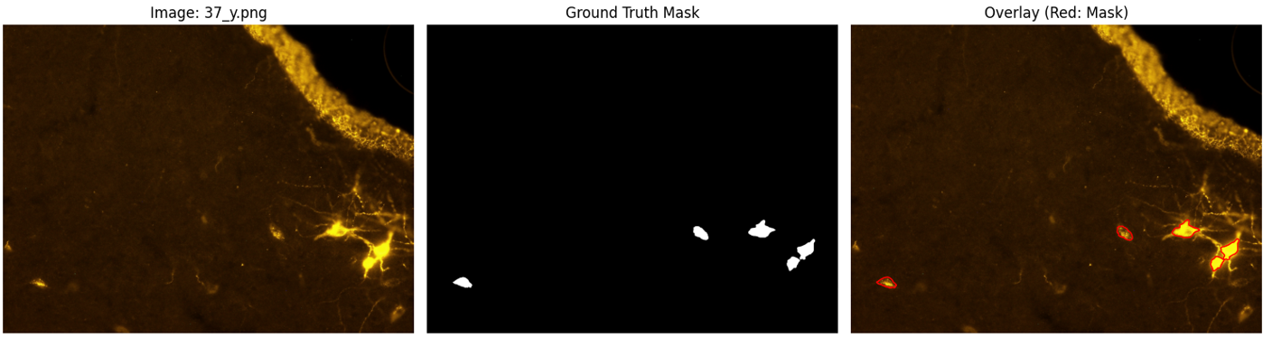Brain Cells Slice Semantic Segmentation Fluorescence-Microscope-Images