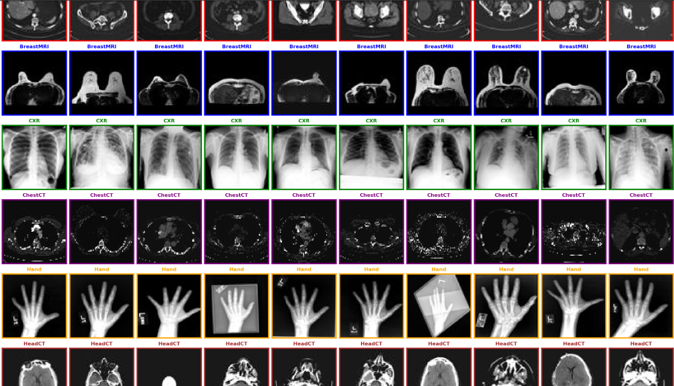 Medical MNIST Classification Resnext50(6Class Dataset)