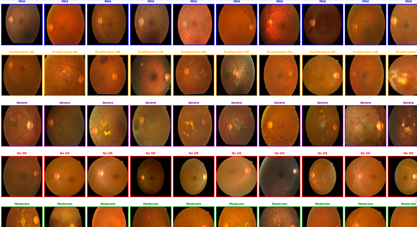 Diabetic Retinopathy Detection