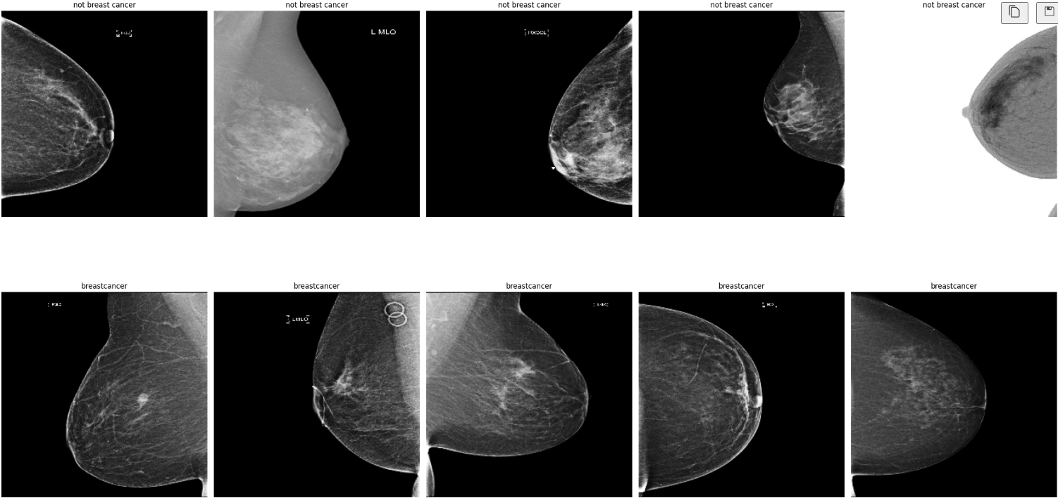 Binary Breast Cancer Detection on Mammogram Images Using Deep Neural Network Models