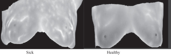Binary Breast Cancer Classification Using MRI Images